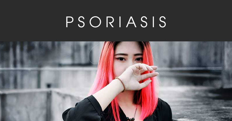 psoriasis